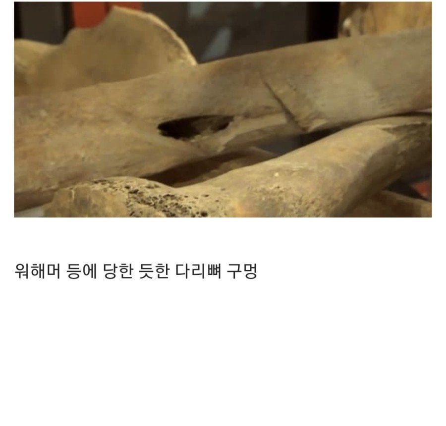 15세기 병사들의 유골 분석 결과