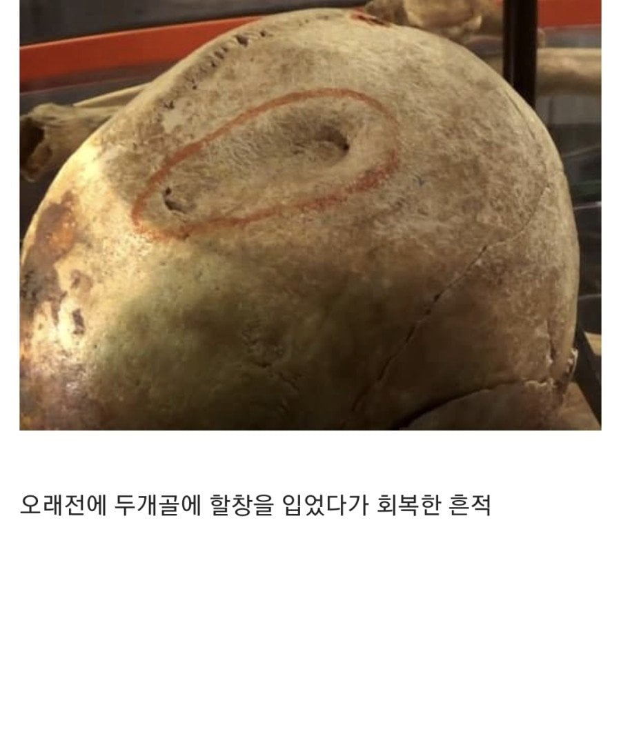 15세기 병사들의 유골 분석 결과