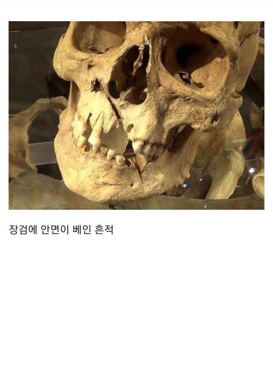 15세기 병사들의 유골 분석 결과