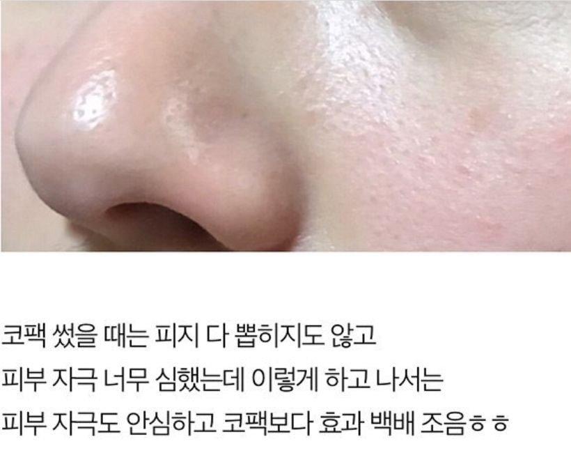 여초에서 유행하는 블랙헤드 없애는법.jpg