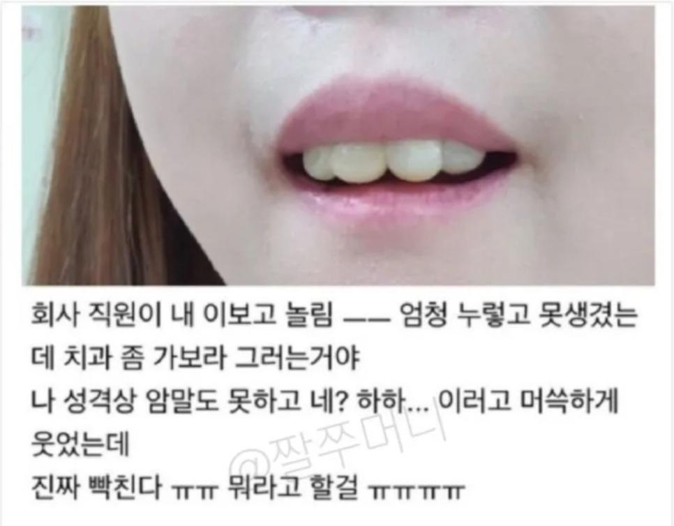 회사 직원이 내 이보고 놀림ㅠㅠ.jpg