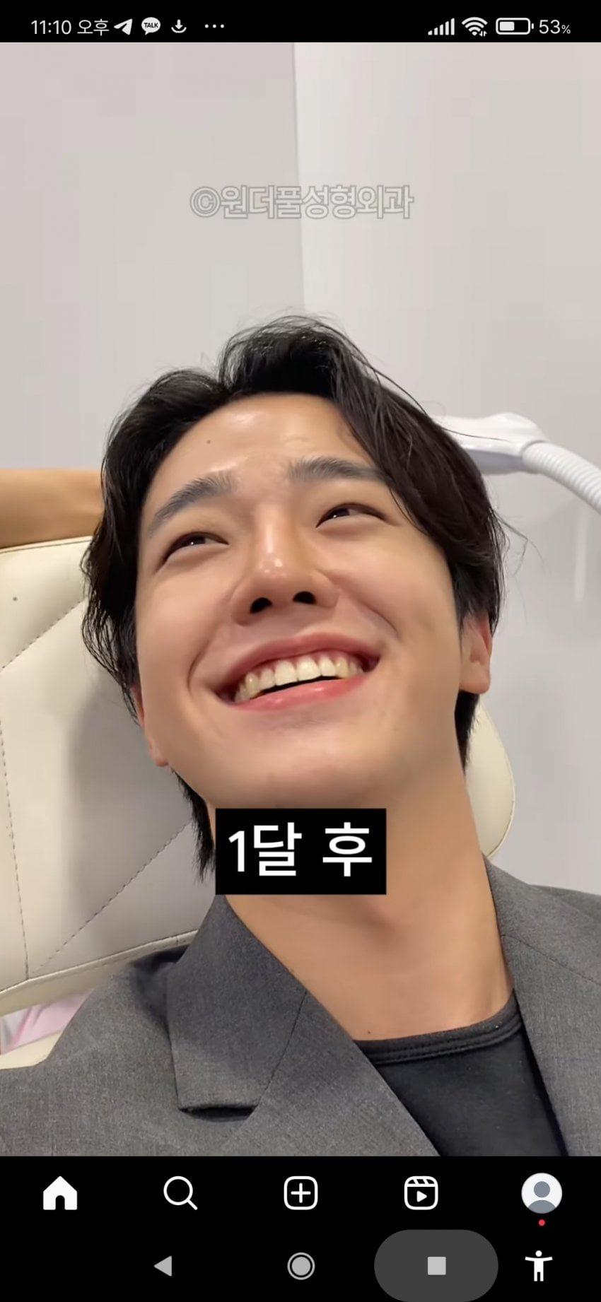 남자 성형수술 전후.jpg