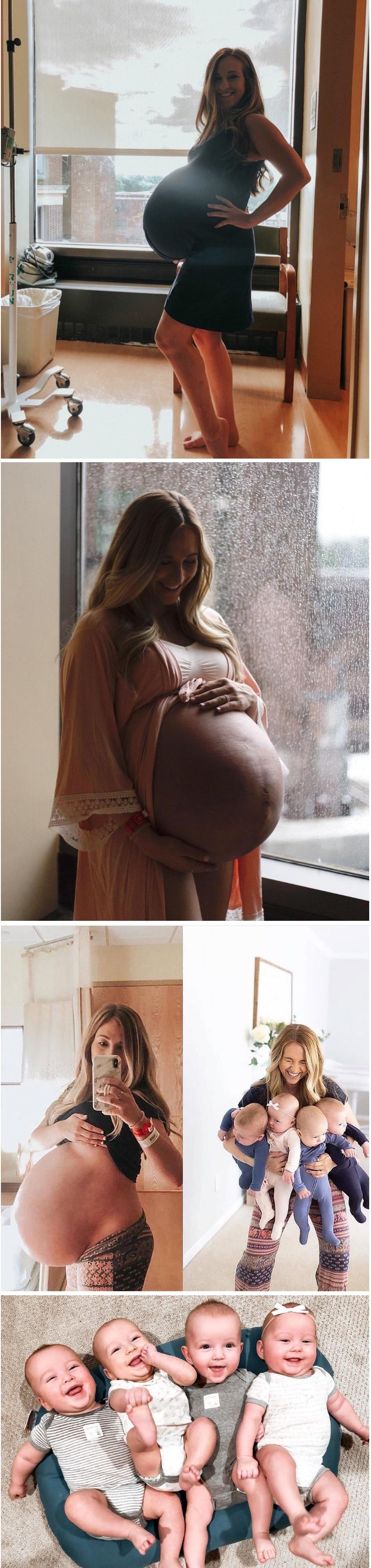 네쌍둥이를 임신한 여성의 배
