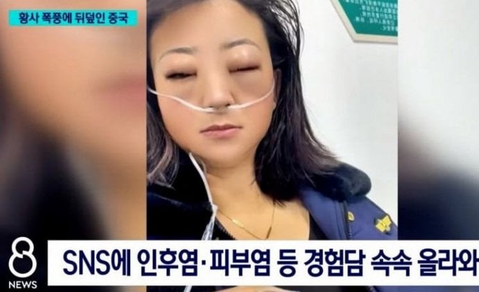 충격적인 중국 황사 근황