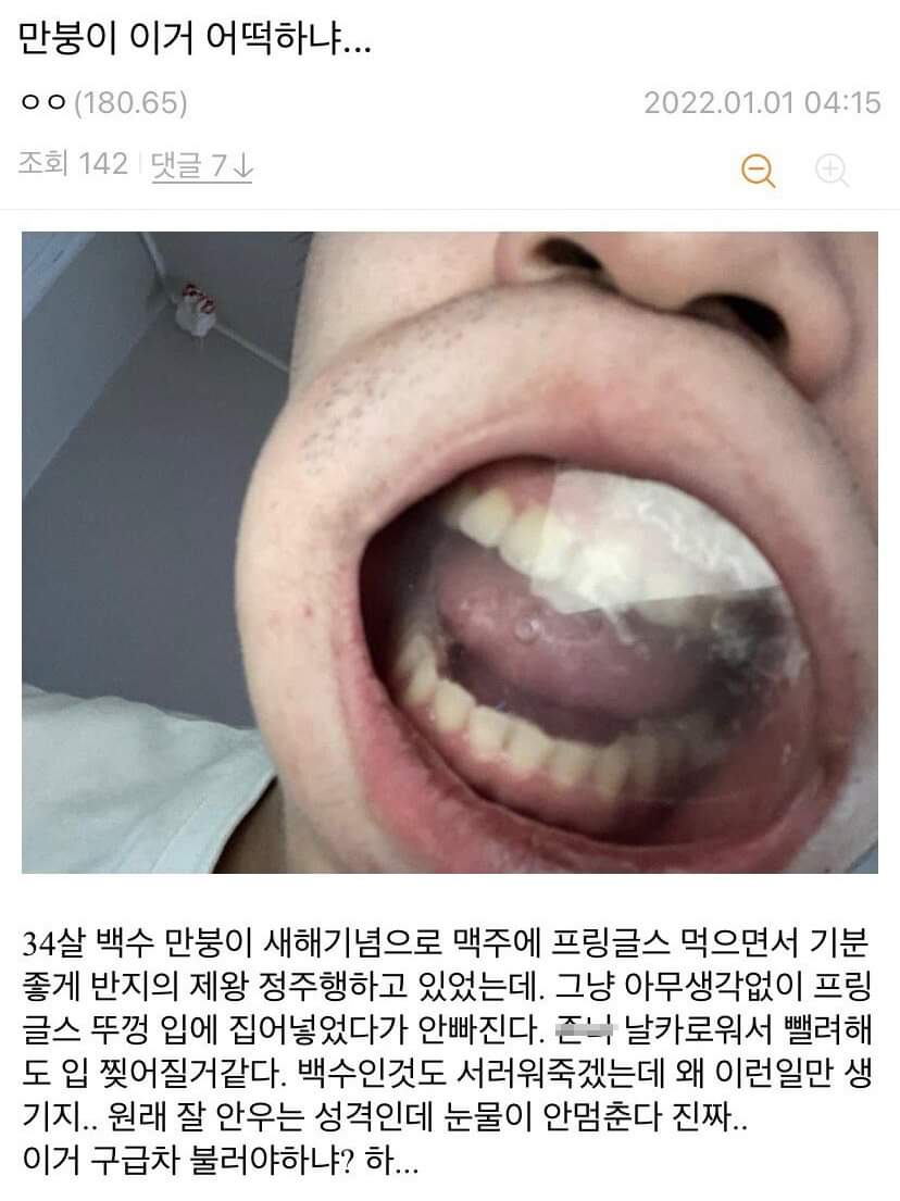 프링글스 뚜껑 입에 낀 디씨인...