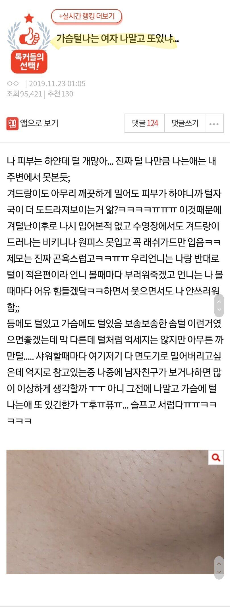 가슴털나는 여자 나말고 또있냐...