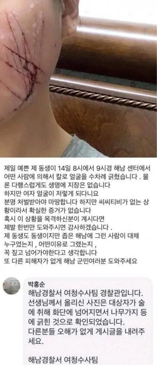 여동생을 이용한 광역어그로