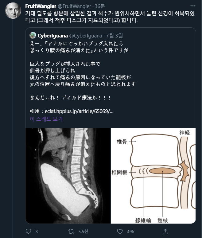 싱글벙글 디스크 치료법