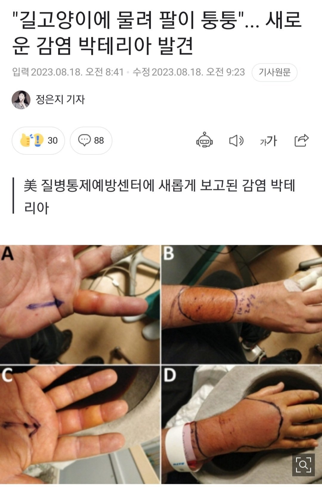 길고양이한테 물린 사람한테 새로운 종류 박테리아 발견 ㄷㄷ