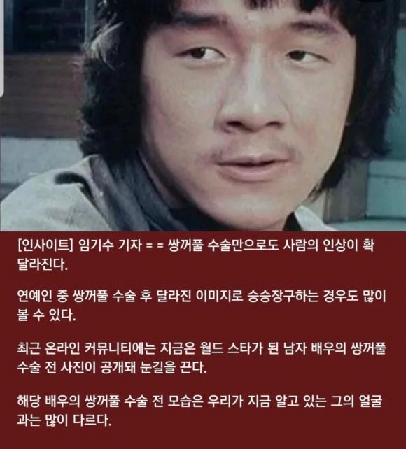 쌍꺼풀 수술만으로 인생이 바뀐 남자..jpg