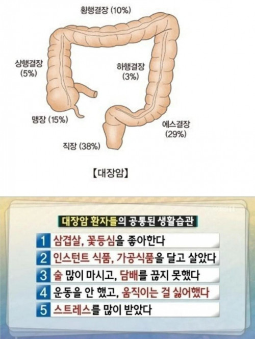 대장암 환자들의 공통된 생활습관