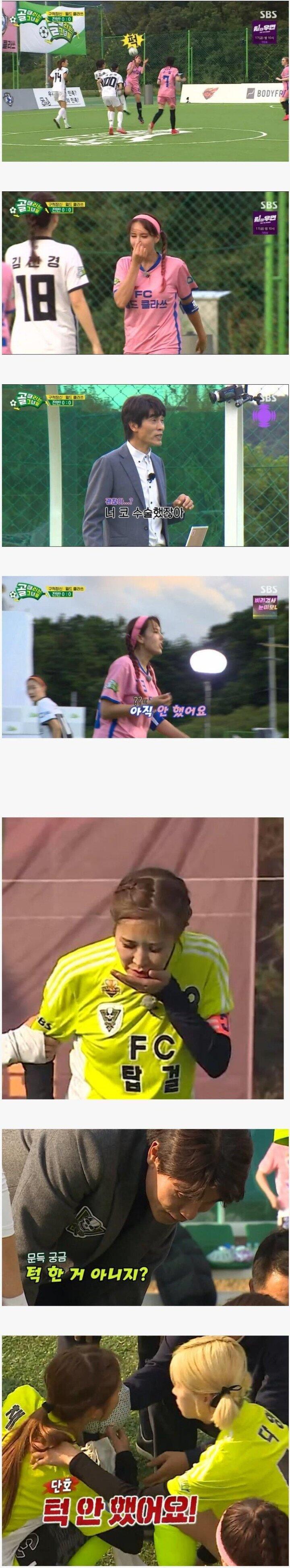 여자연예인 성형 알아보는법