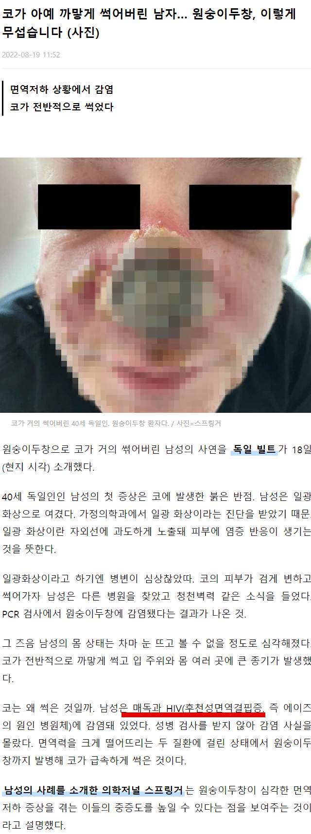 코박죽하다 코가 썩은 남자 ㅗㅜㅑ...jpg