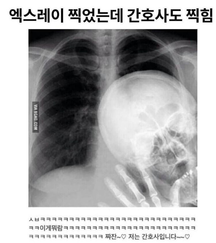 엑스레이에 내가 아닌게 나옴
