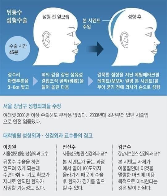 무시무시한 요즘 성형 수술