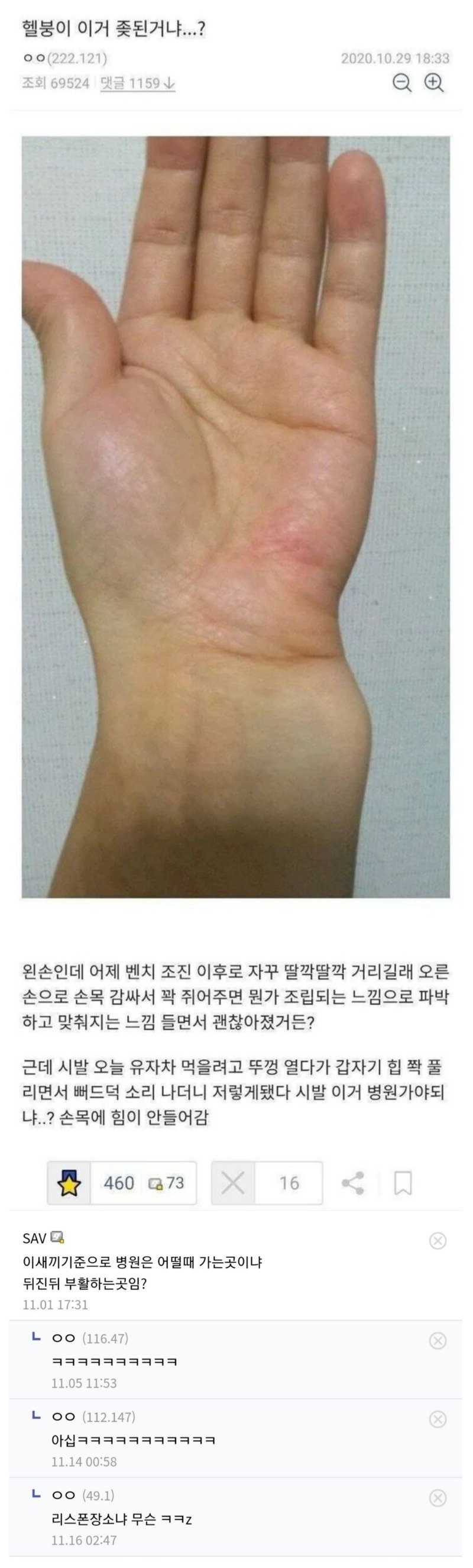 손목 브레이커를 본 응급의학과 교수님