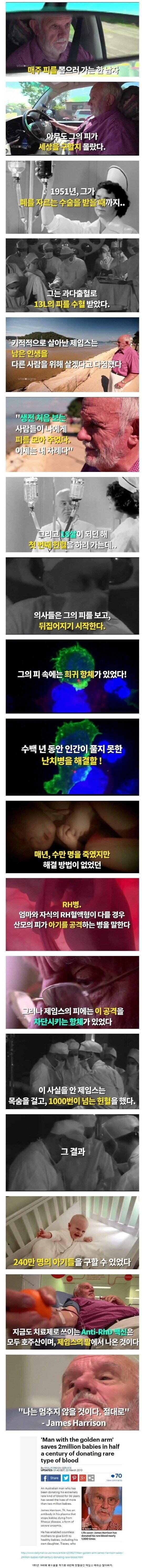 한 사람의 팔로 구한 240만명의 생명