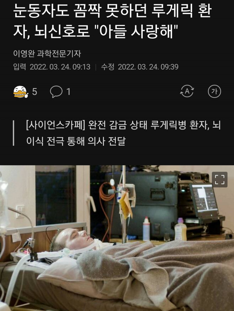 과학기술 근황... 싸펑에서나 보던 이식물 성공