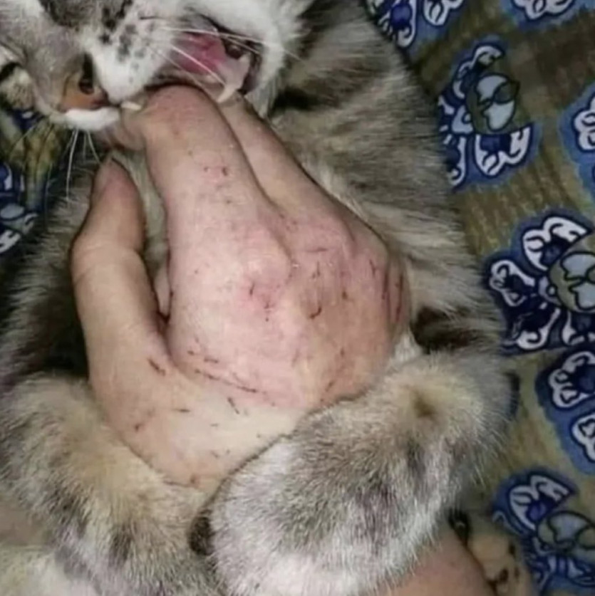 사랑은 고통이다